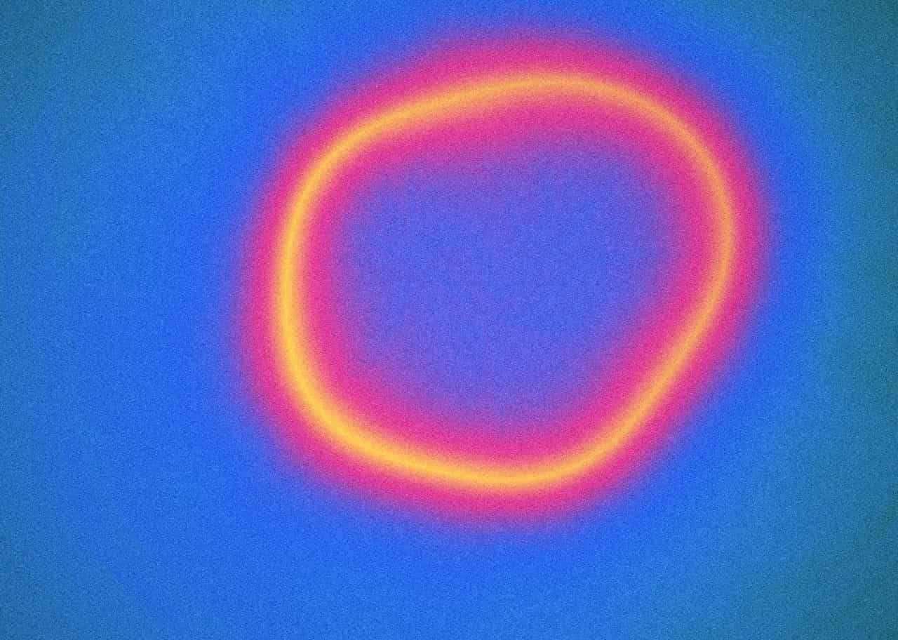 Kirlian 004